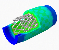 血管支架有限元分析解决方案